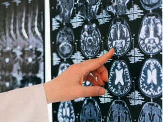 Doctor pointing at brain MRI