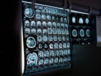 A black screen with blue several MRI pictures of brains